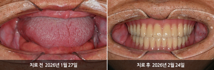 더신중한치과 전후사진