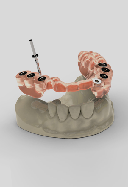 더신중한치과 임플란트
