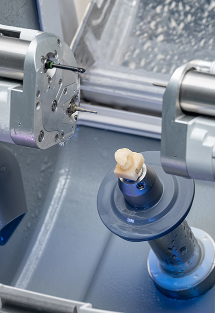 더신중한치과 원데이 보철