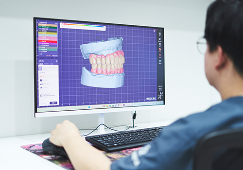 보철물 디자인 및 제작