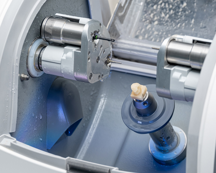 원데이 라미네이트